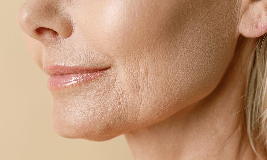 Fine lines and skin laxity — NeoGen at Woodside Skin Clinic