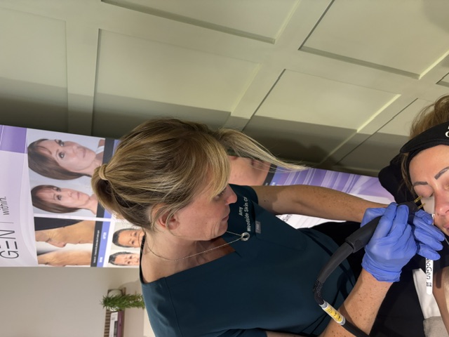 Amy delivering a NeoGen plasma treatment at Woodside Skin Clinic